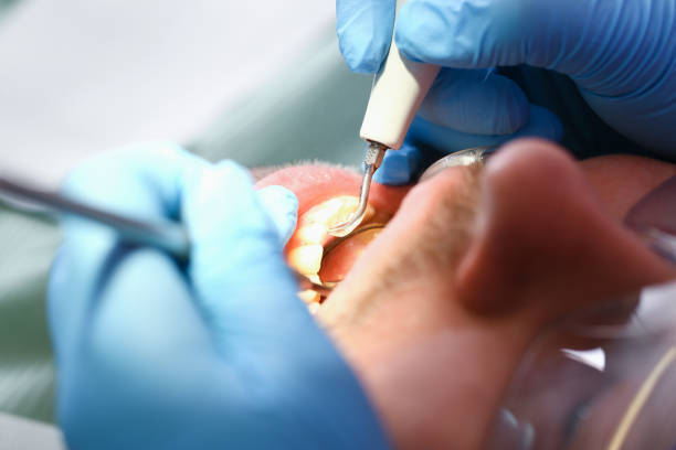 Best Pediatric Emergency Dentist in North Hills, NY