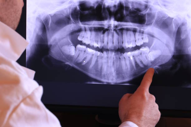 Best Emergency Dentist for Lost Fillings or Crowns in North Hills, NY