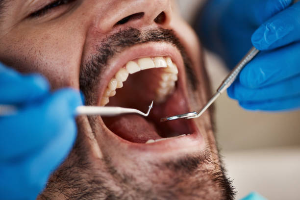 Best Emergency Dental Services for Seniors in North Hills, NY